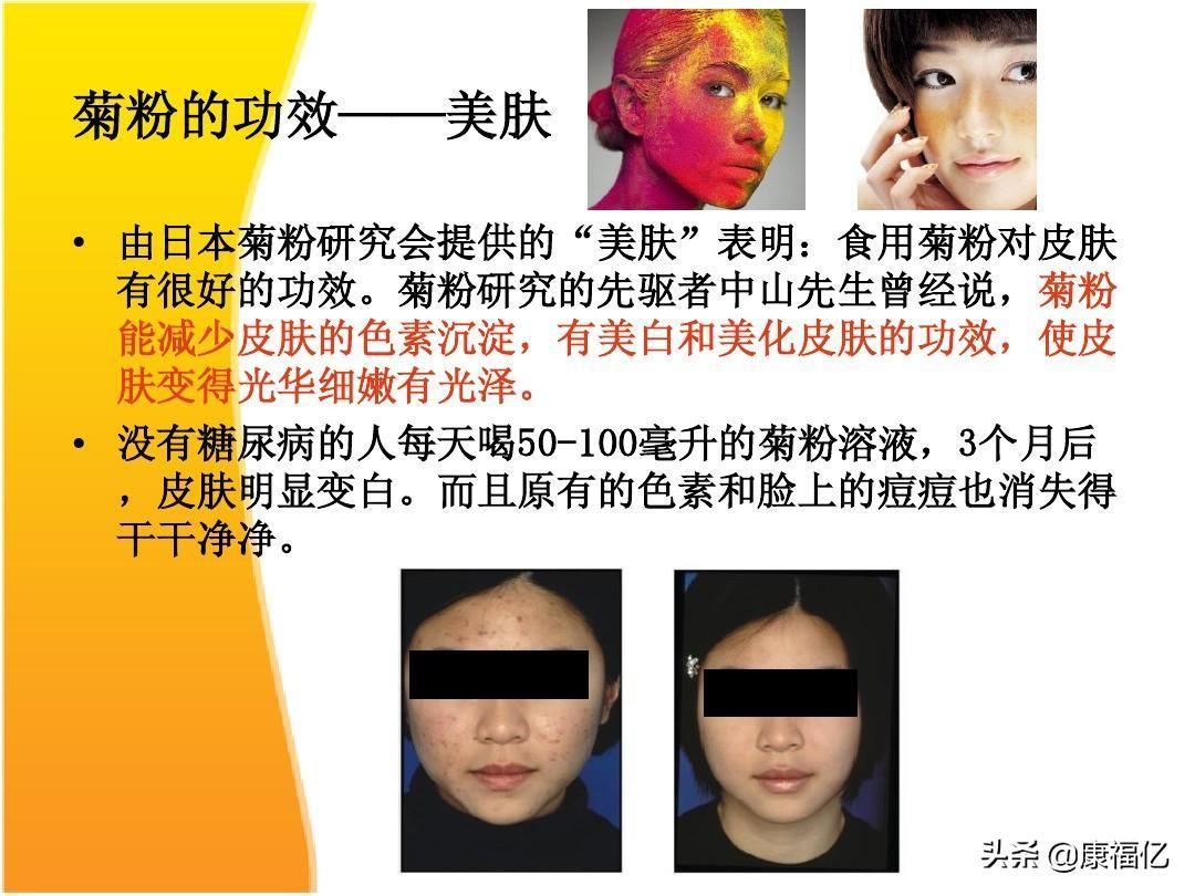 菊粉是什么功效与作用(益生菌菊粉是什么功效与作用)