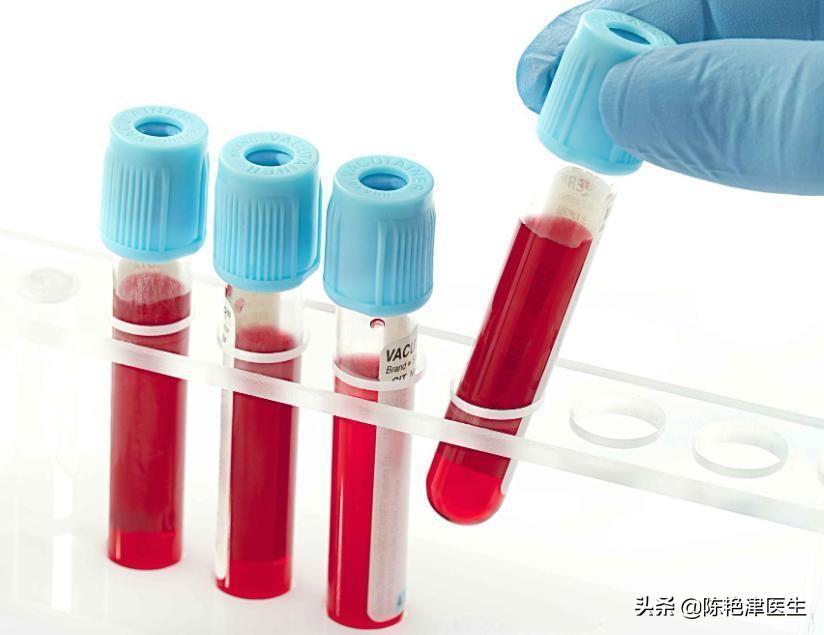 长期吃氨氯地平和硝苯地平，3个危害要重视！医生教你应对方法